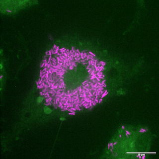 Rock Lab's image of murine macrophages (green) with Mabs bacilli (magenta).